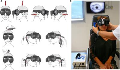 The Skull Vibration-Induced Nystagmus Test of Vestibular Function—A Review